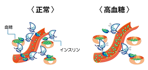 血糖コントロールのイメージ