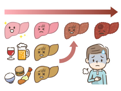 脂肪肝の原因
