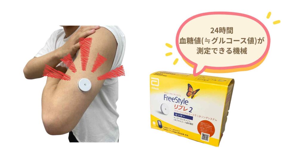 糖尿病フリースタイルリブレ