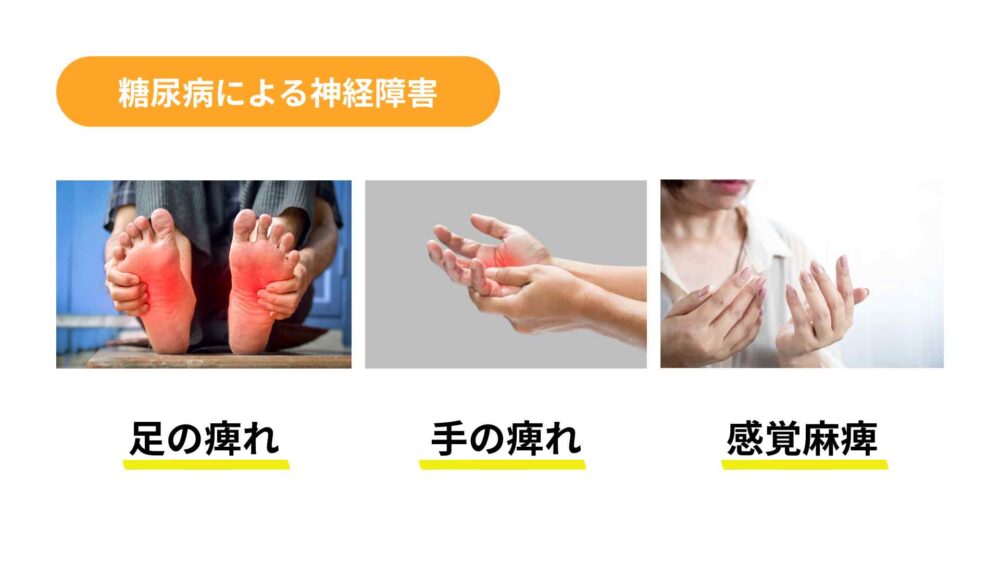 糖尿病の手足の痺れ(神経障害)